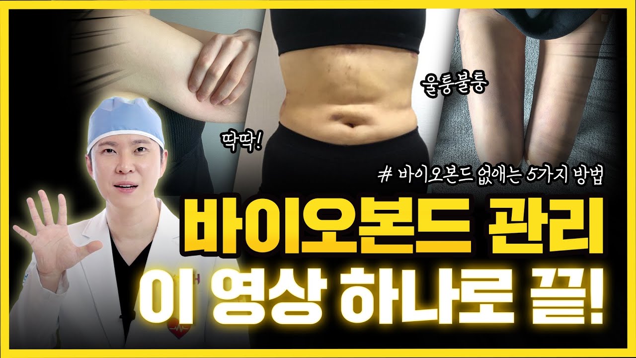 지방흡입 후 바이오본드 빨리 해결하는 방법! 병원 후 관리부터 셀프 마사지까지 👉 바본없애기, 지방흡입관리👈