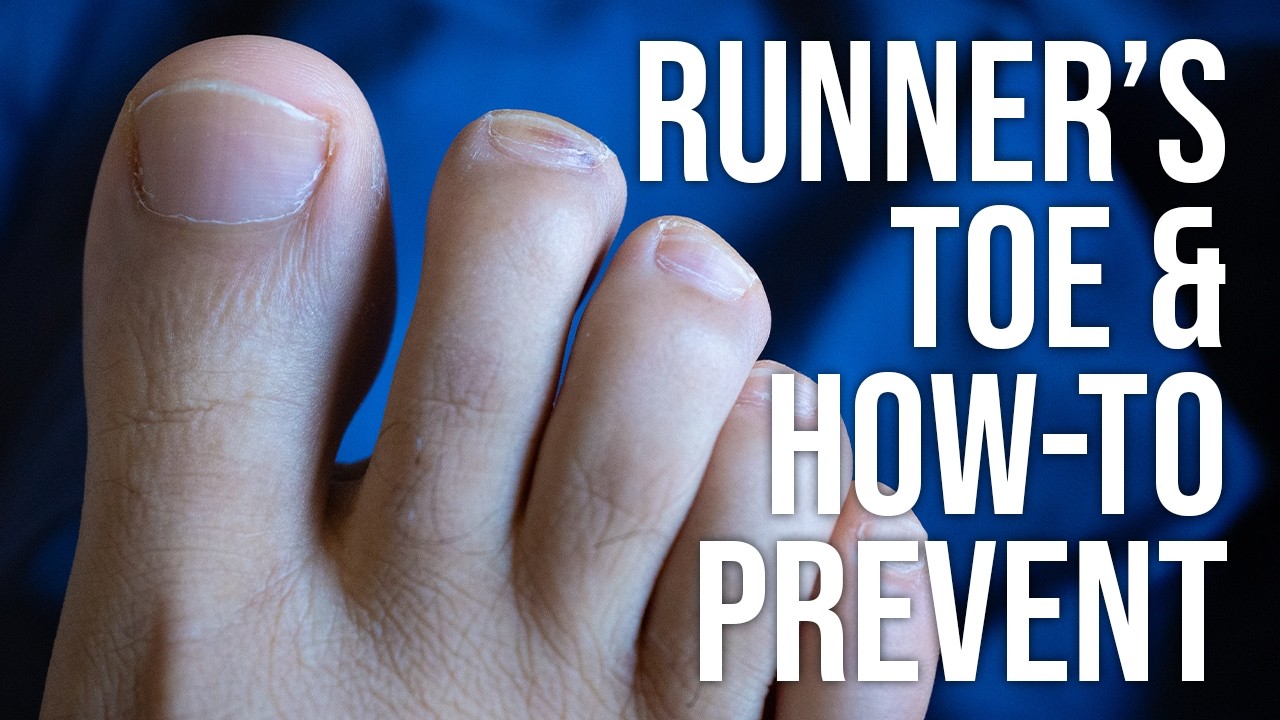 Накладки на носки бегунов и силиконовые накладки на носки для профилактики