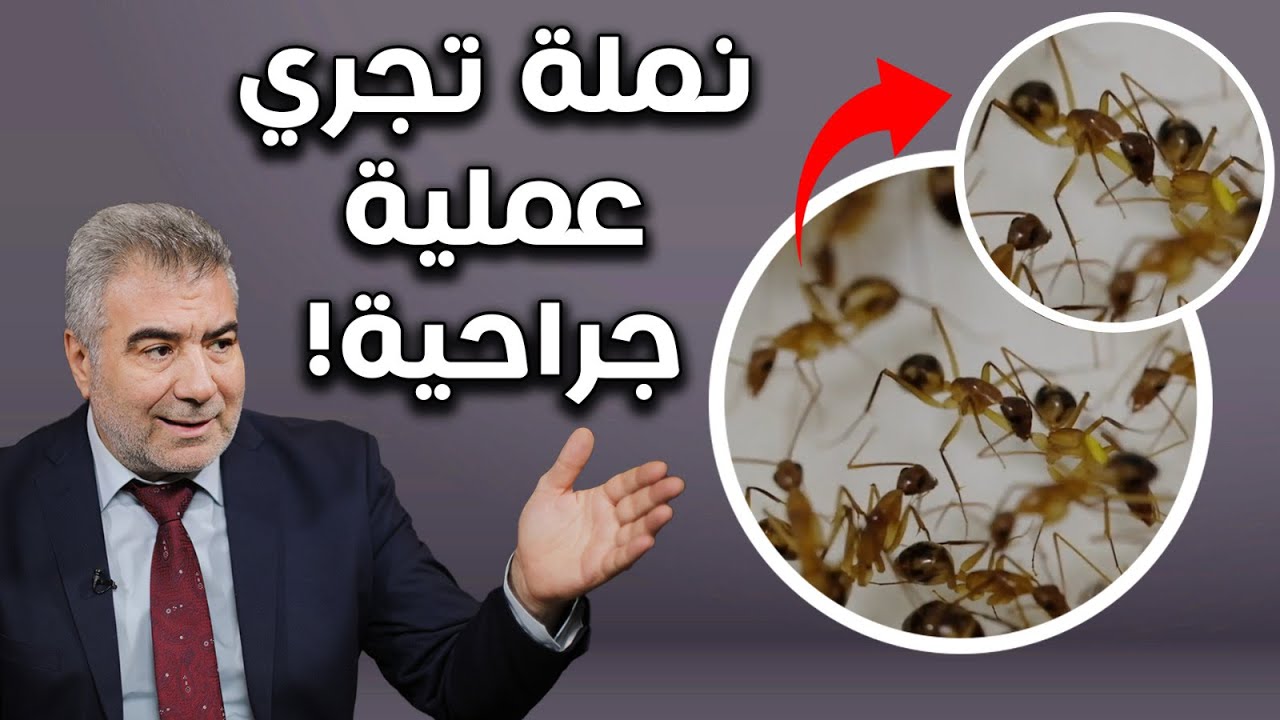 أمر لا يصدق.. نملة تجري عملية جراحية! شاهد إبداع الخالق