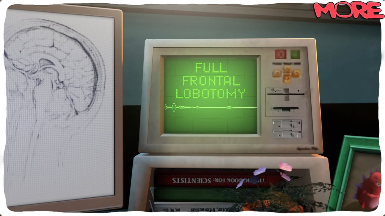 kryoz - full frontal lobotomy