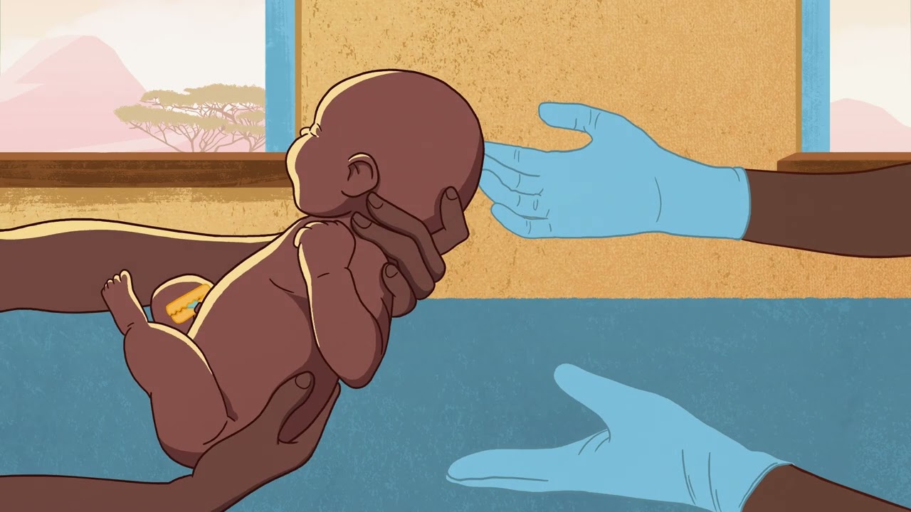 Explainer: The first response treatment for postpartum haemorrhage