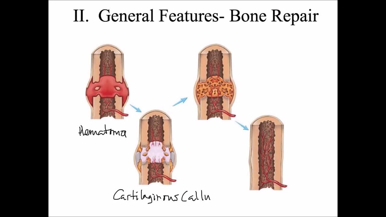 Ремоделирование и восстановление костей