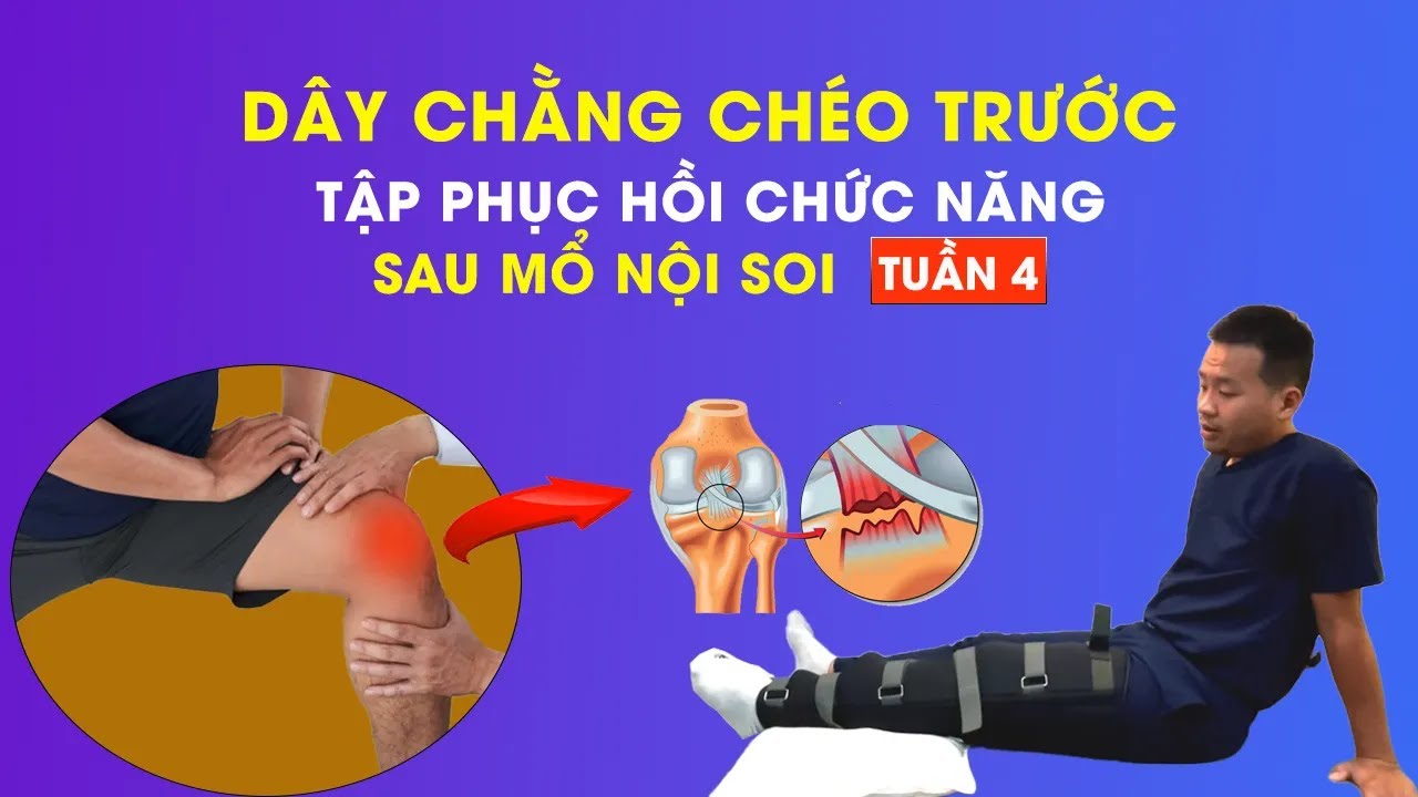 Tập Phục Hồi Chức Năng Sau Mổ Nội Soi Dây Chằng Chéo Trước - Tuần 4