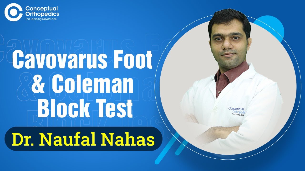Cavovarus foot and Coleman block test by Dr. Naufal Nahas 