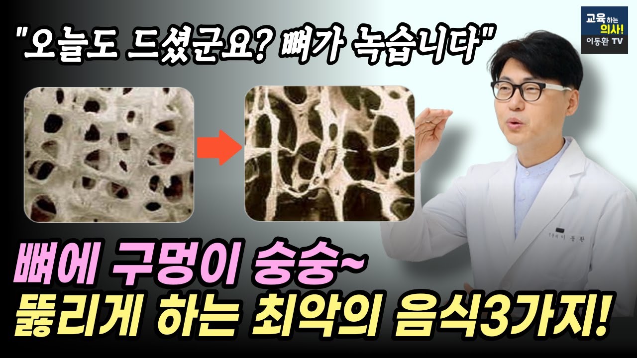 뼈를 녹이는 최악의 음식. 나도 모르게 매일 먹는 이 음식이 골다공증을 만듭니다. 골감소증.
