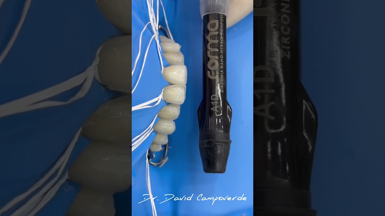 Diseño de sonrisa con materiales Ultradent.  🦷😁