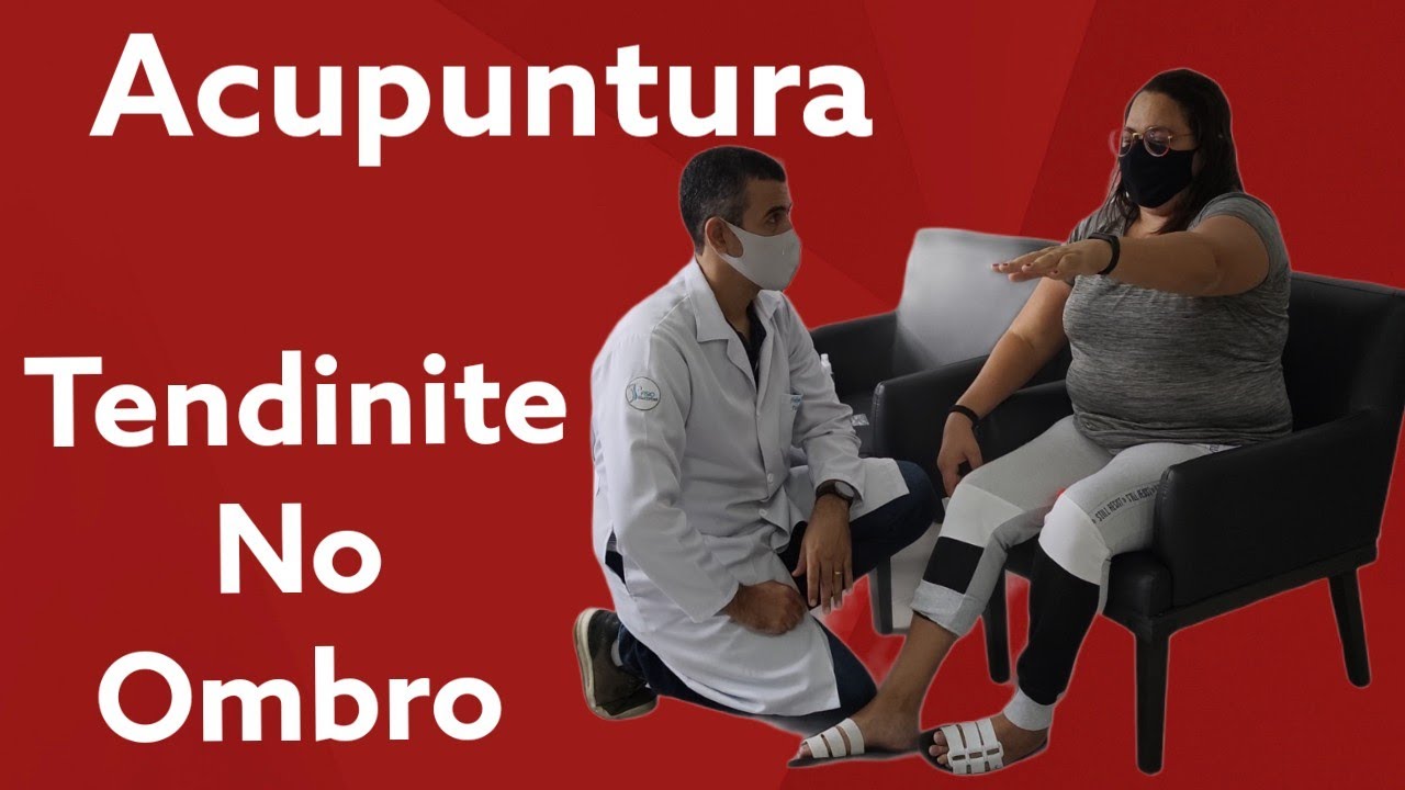 Acupuntura para Tendinite no Ombro