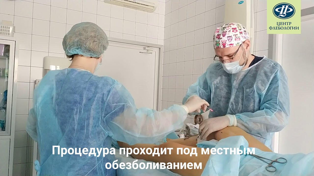 Как проходит ЭВЛК: лечение варикоза лазером в «Центре Флебологии»