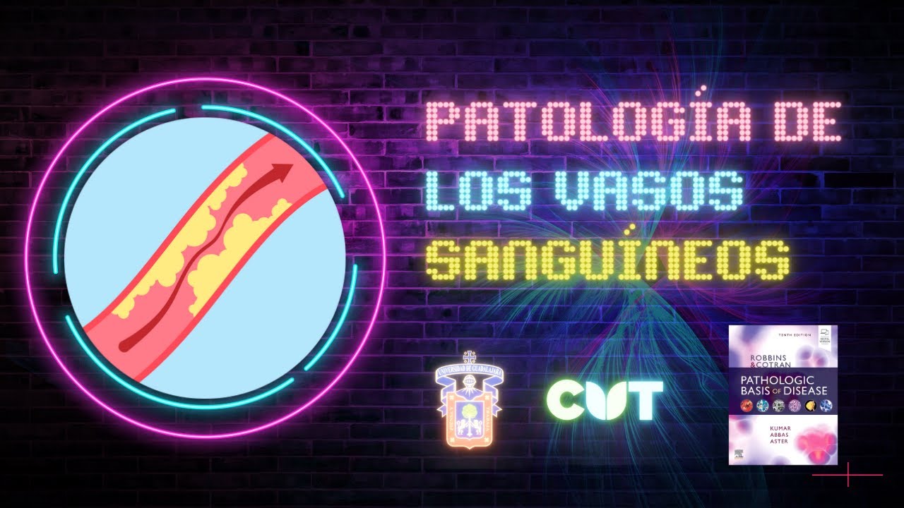 Emisión en directo - Patología de los vasos sanguíneos-  Curso 2023A
