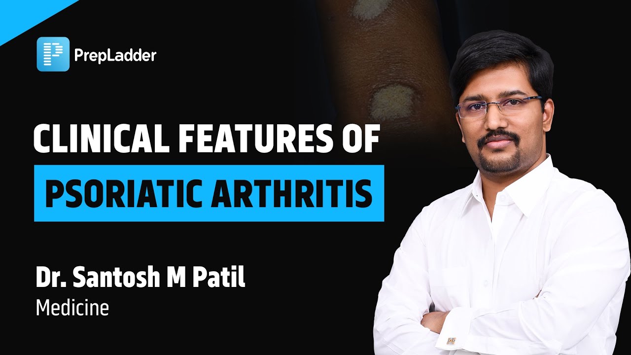 Clinical Features of Psoriatic Arthritis by Dr. Santosh M Patil