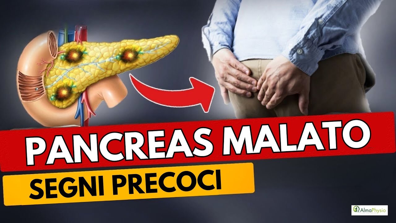 TUMORE AL PANCREAS: i segni PRECOCI di un problema SERIO