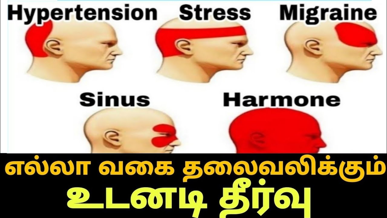 Headache Treatment Tamil - Thalaivali Udane Neenga - Home Remedies