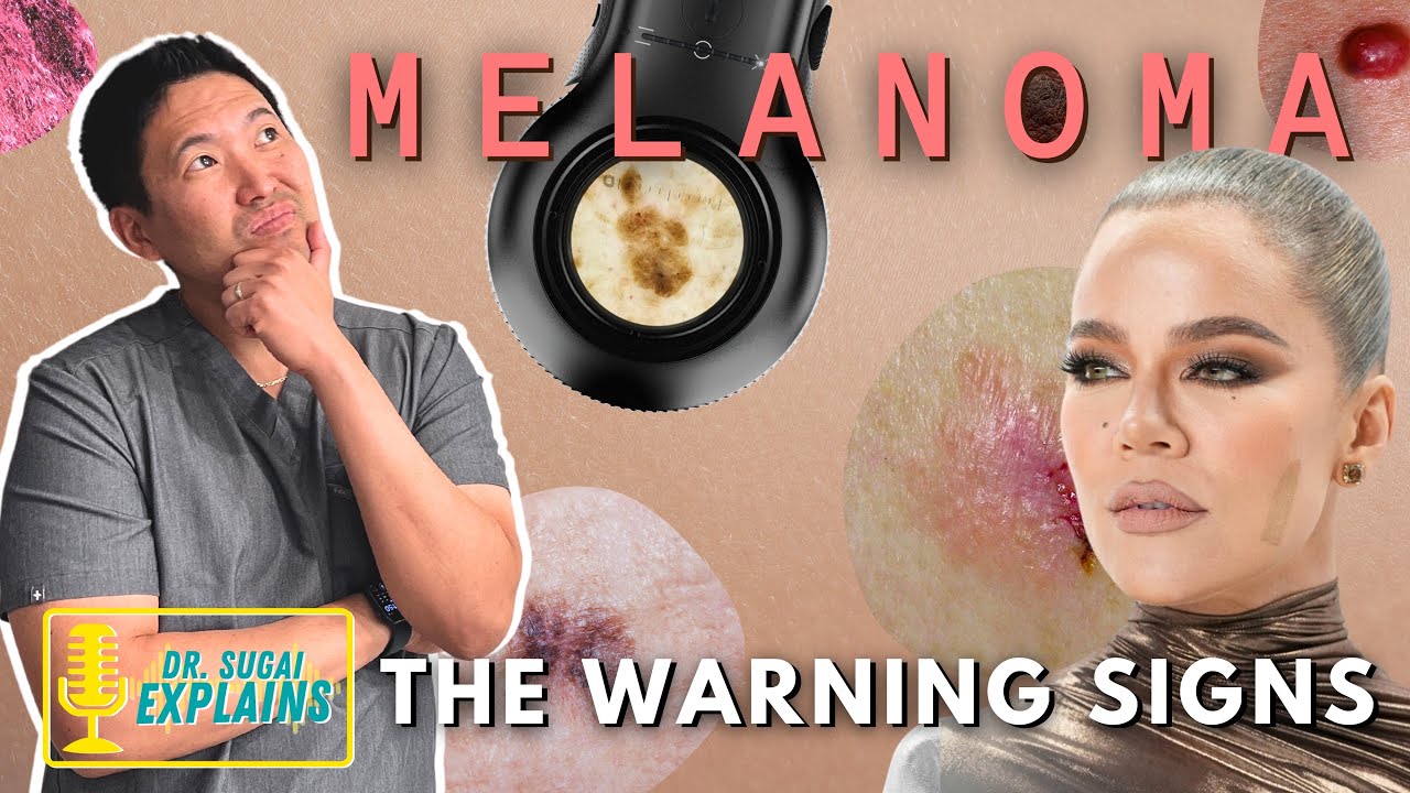 Dermatologist Explains: Warning Signs of Skin Cancer