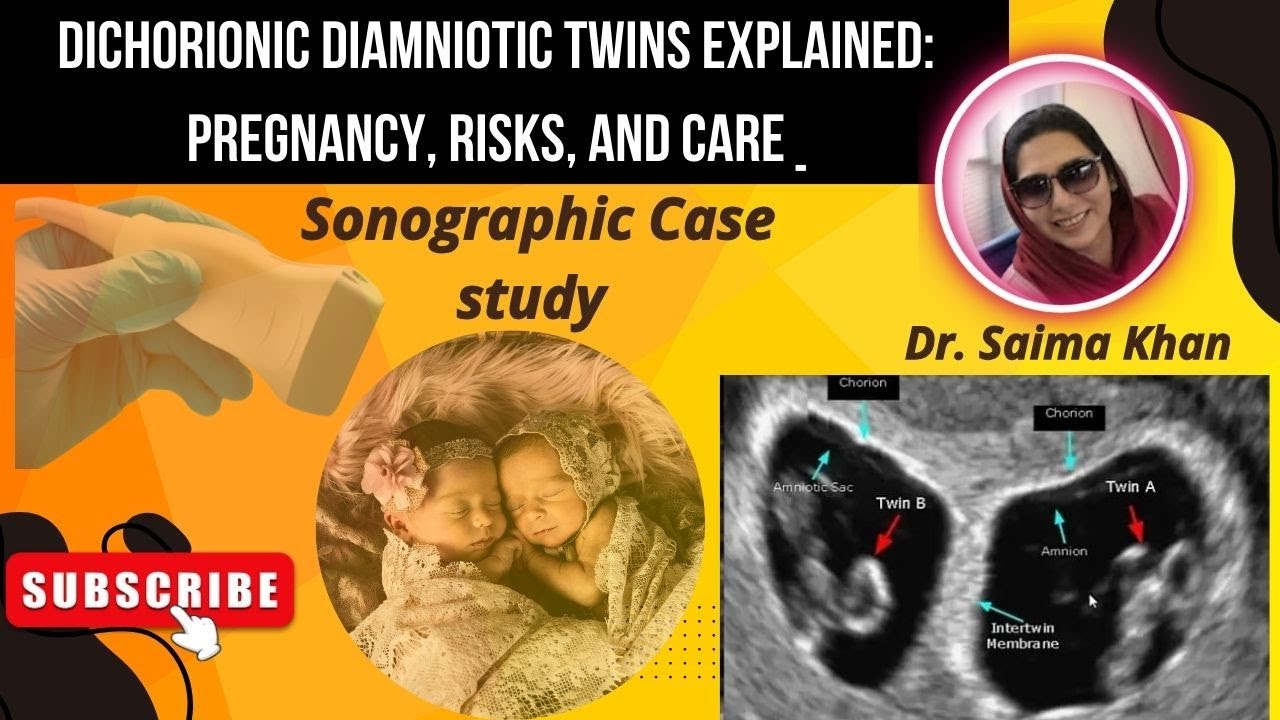 Dichorionic Diamniotic Twins Explained: Pregnancy, Risks, and Care 