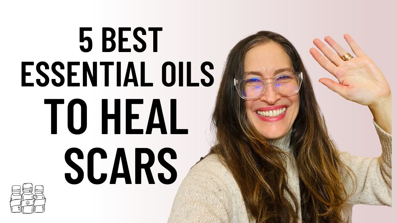 5 Best Essential Oils for Healing Scars