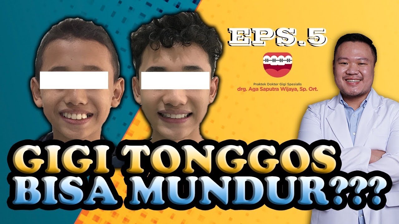 Gigi tonggos bisa mundur???