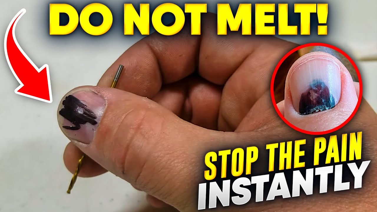 Остановите боль прямо сейчас! Вот как МГНОВЕННО починить сломанный ноготь