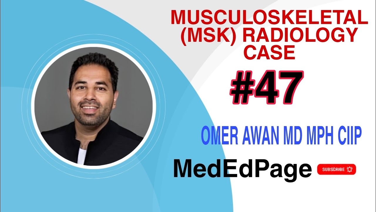 Musculoskeletal (MSK) Radiology CASE  #47