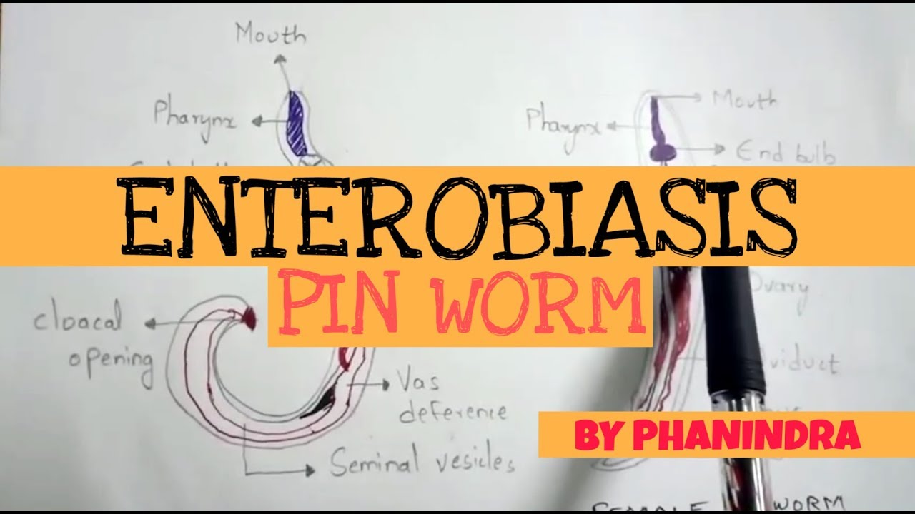 ENTEROBIASIS || PINWORM || STRUCTURE || LIFE CYCLE || SYMPTOMS || BY PHANINDRA GUPTA