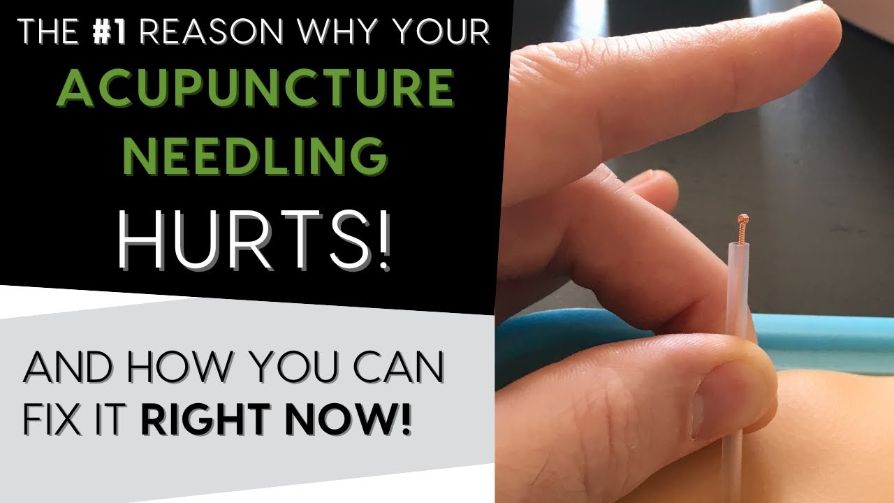 The #1 Reason Why Acupuncture is Painful