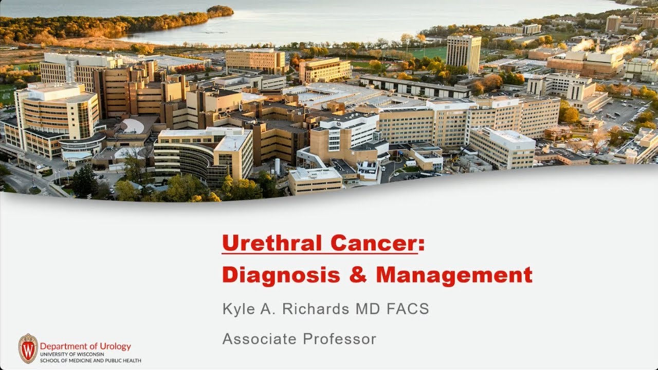 UW Urology Grand Rounds: Contemporary Management of Urethral Cancer - 6/18/25