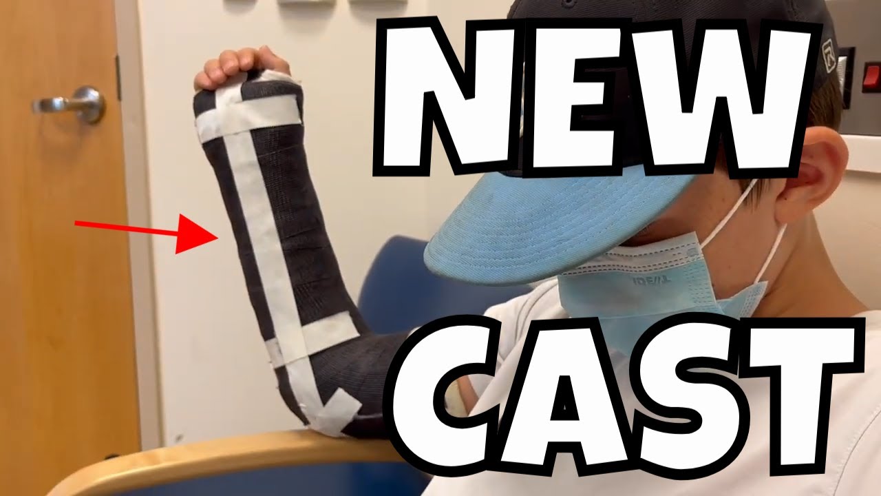 BROKEN ARM #4 | PART 3: WILL OWEN NEED SURGERY FOR HIS BROKEN ARM?
