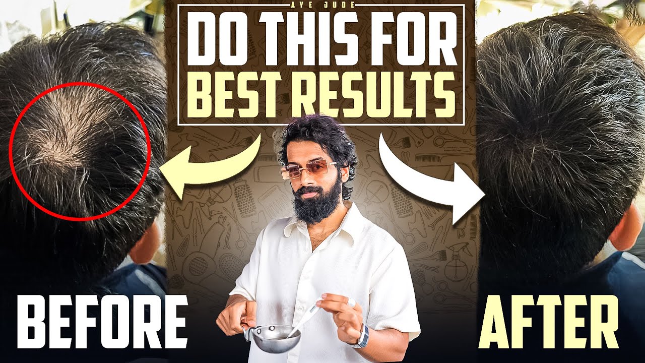 Reverse *HAIRFALL* Naturally🌿(5 steps)