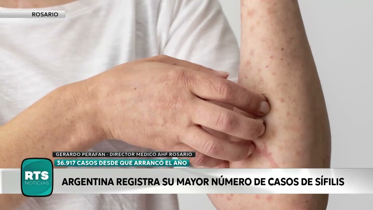 19/11 Entrevista a Dr. Gerardo Perafan, AHF Argentina