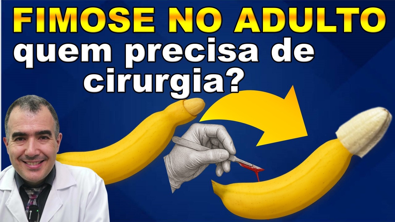 FIMOSE NO ADULTO: quem precisa da cirurgia?