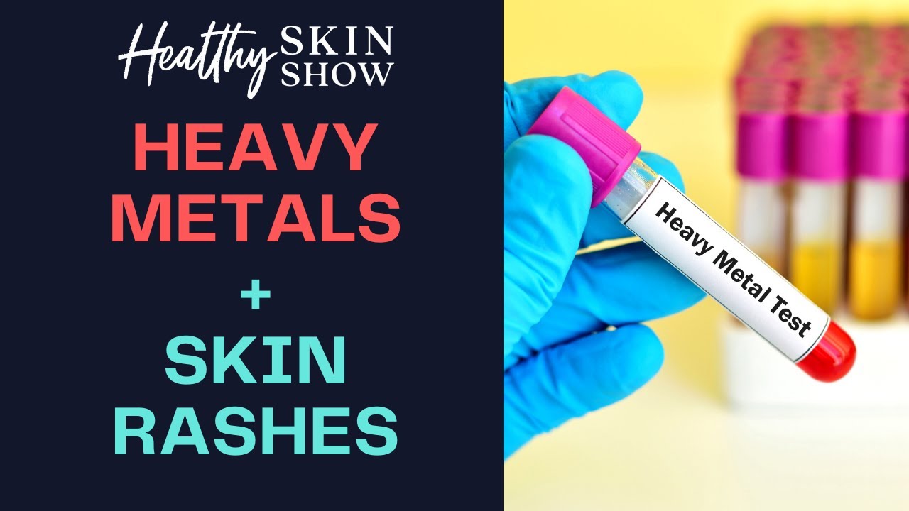 HEAVY METALS + Skin Rashes | Dr. Sonza Curtis