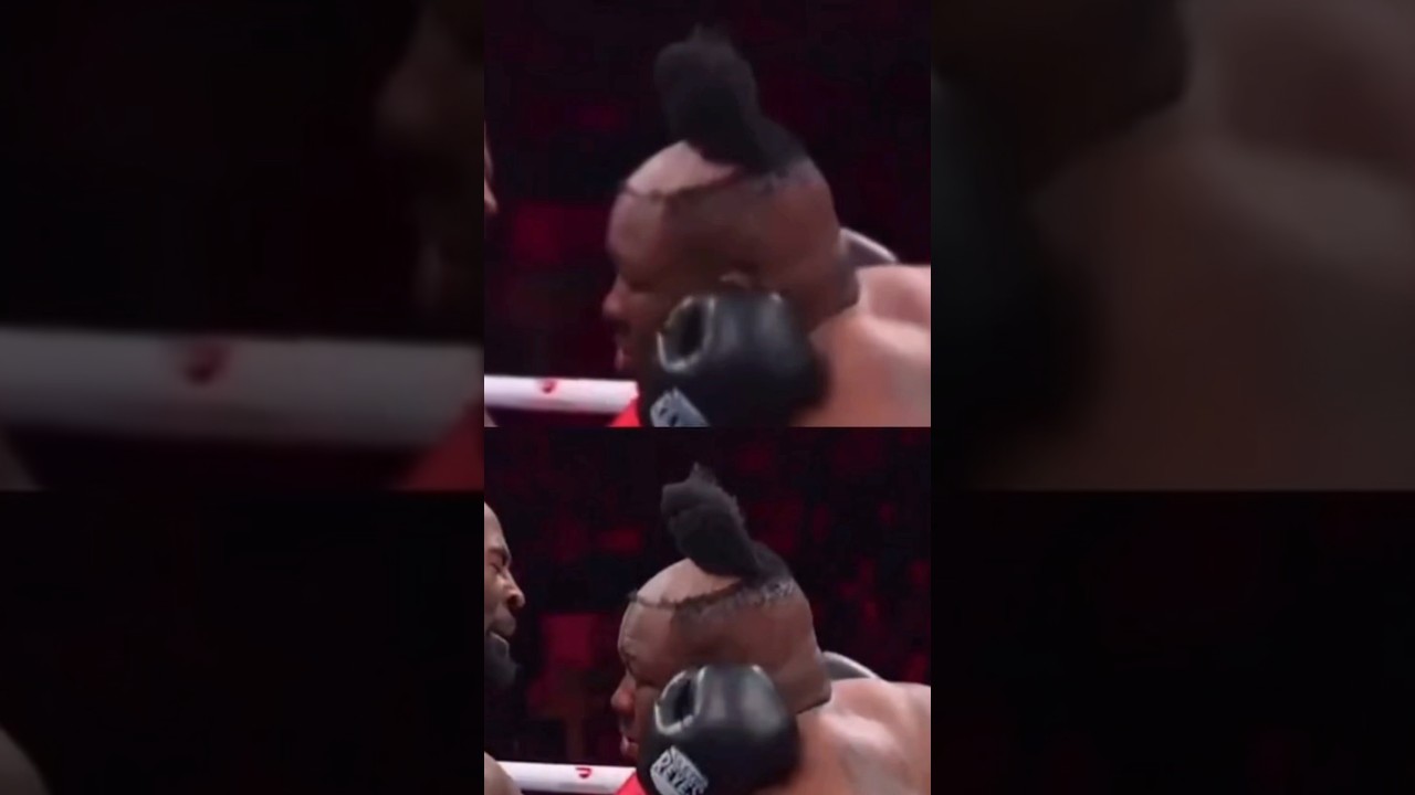 “Big Baby miller” wins fight but looses his Hair 