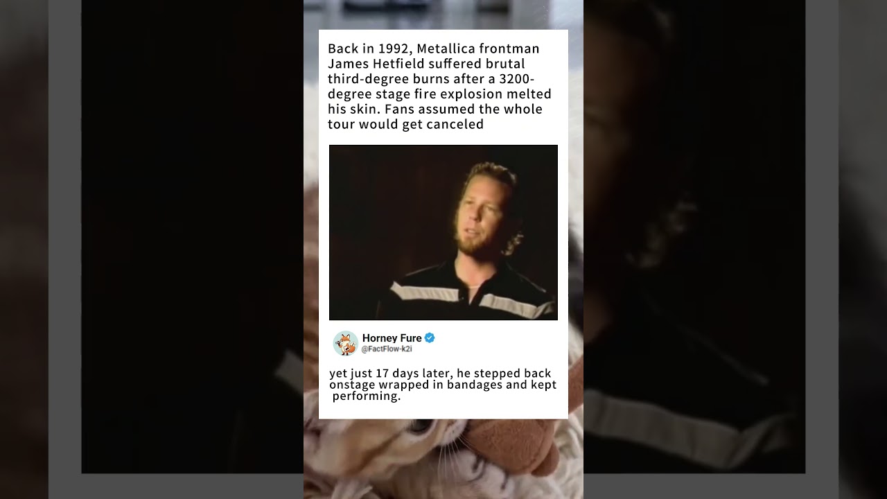 James Hetfield Got Third-Degree Burns From 3200&deg;F Pyro Blast & Returned To Stage In Only 17Days#news