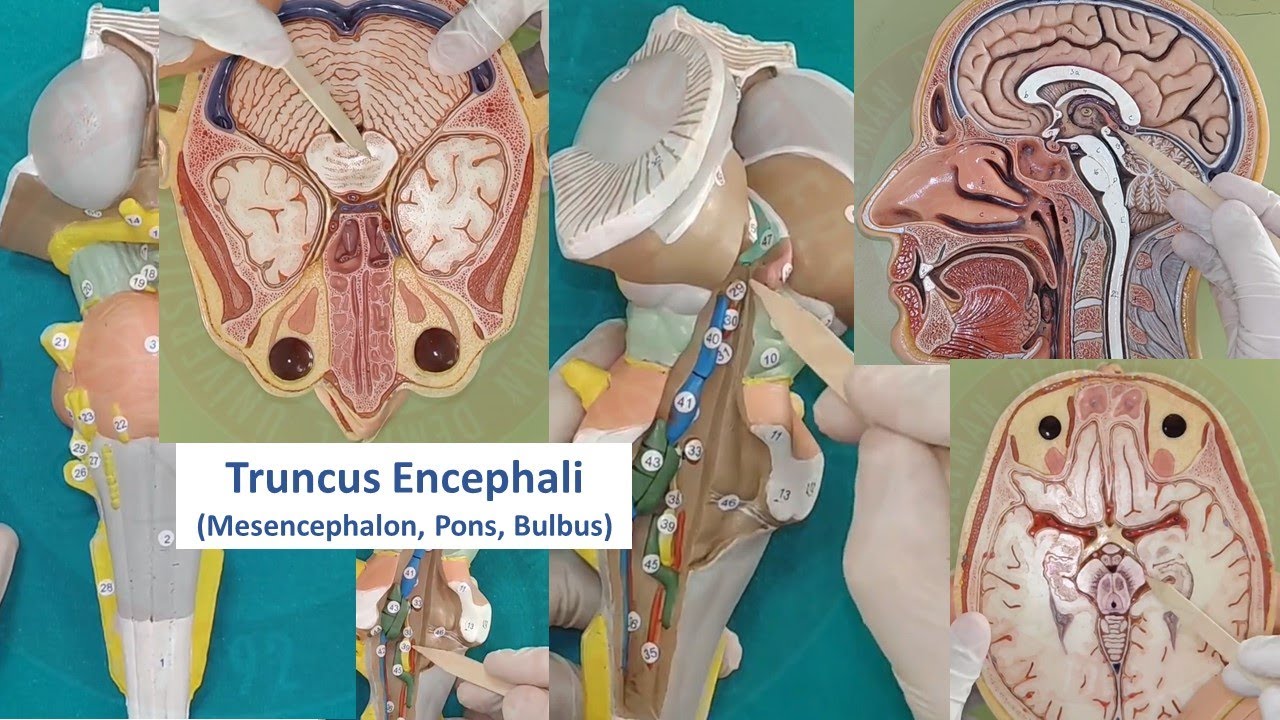 Truncus Encephali (Mesencephalon, Pons, Bulbus)