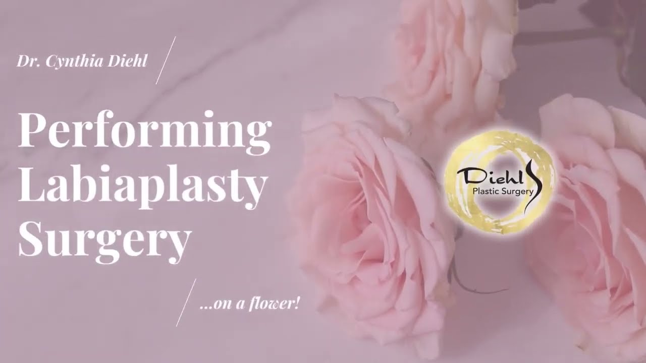 Labiaplasty | Surgery Demonstration on a Flower | Dr. Cynthia Diehl