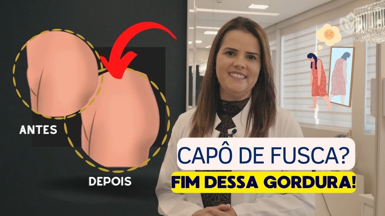 GORDURA NO MONTE DE VÊNUS: COMO REDUZIR O VOLUME?│Dra. Raquel Camelo