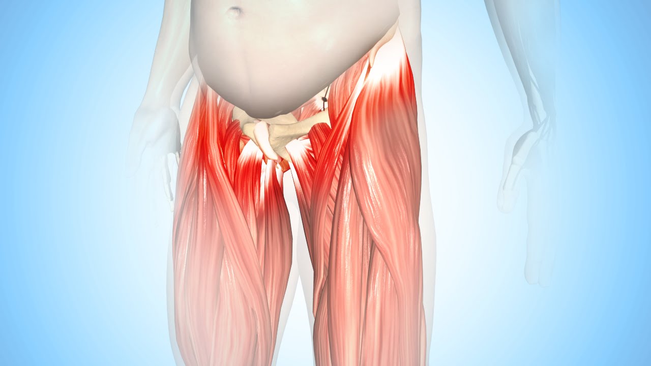 Best Exercises for Hip tendonitis