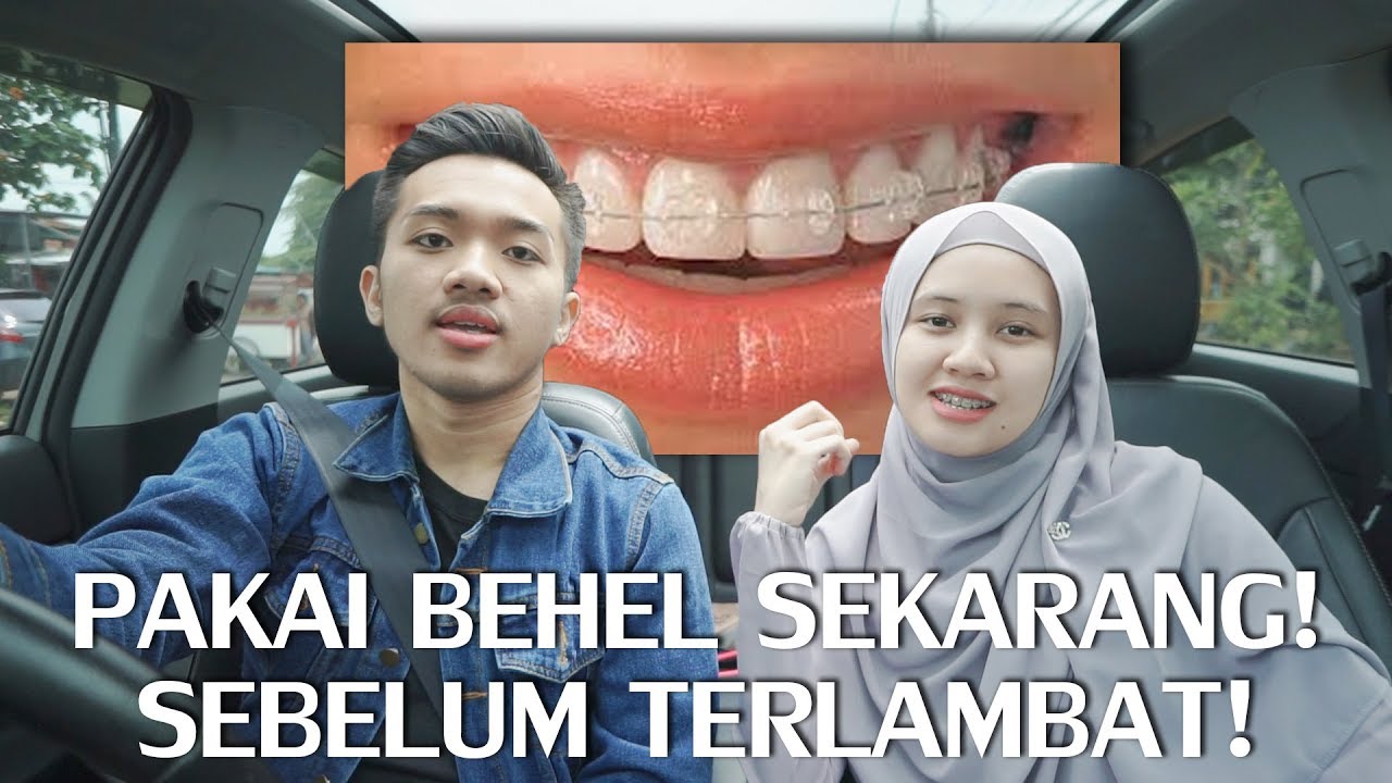 KENAPA KITA PAKAI BEHEL? | MY DAMON CLEAR BRACES STORY #2