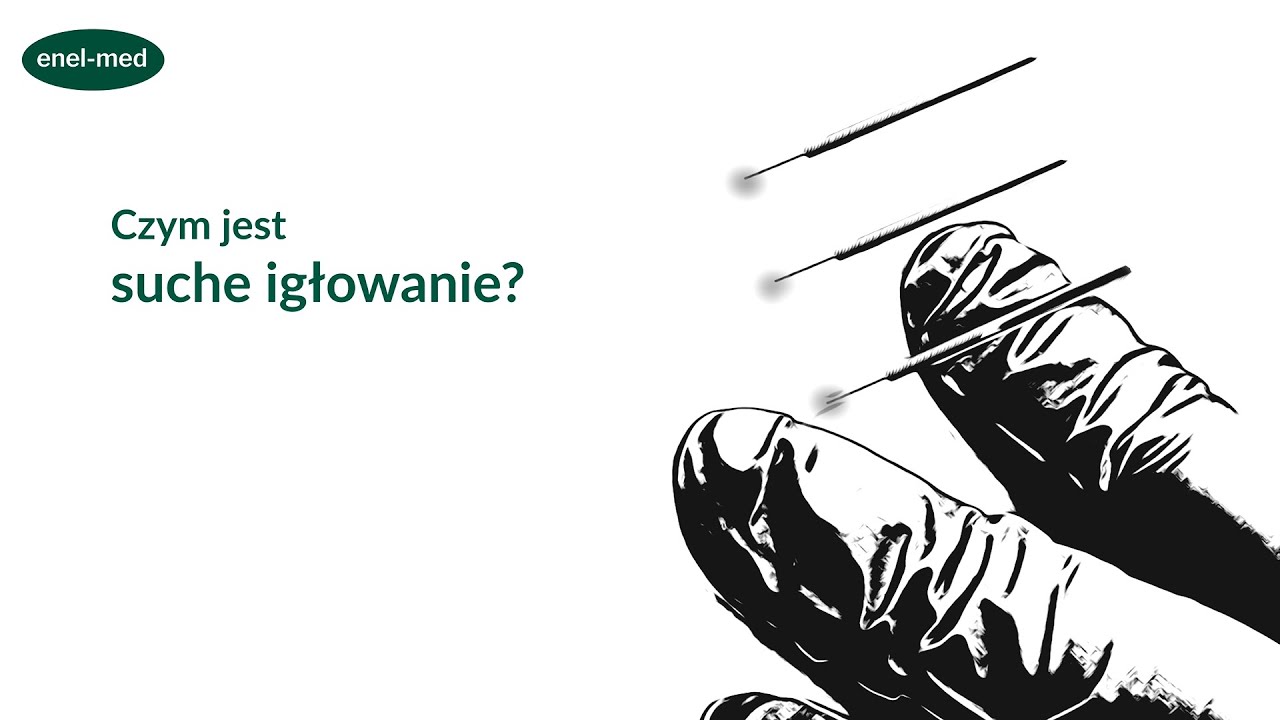 Czym jest suche igłowanie?