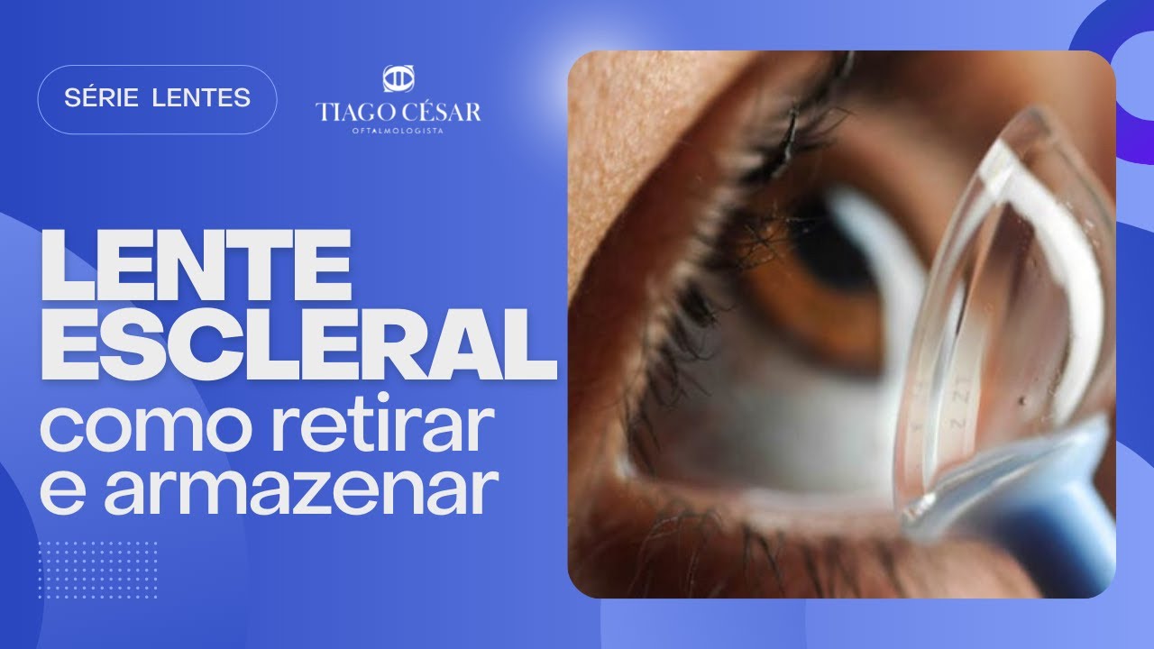 Como Retirar Lente Escleral? | Principais Cuidados com as Lentes Esclerais | Dr. Tiago César - BH