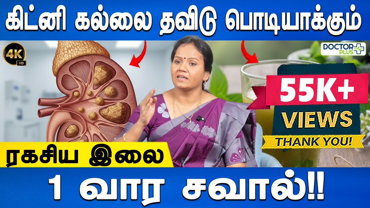 மறுபடியும் கல் வராமல் தடுக்க ஒரு ட்ரிக்! | Kidney Stone homeremedy | Dr.Jayaroopa | Doctor Plus