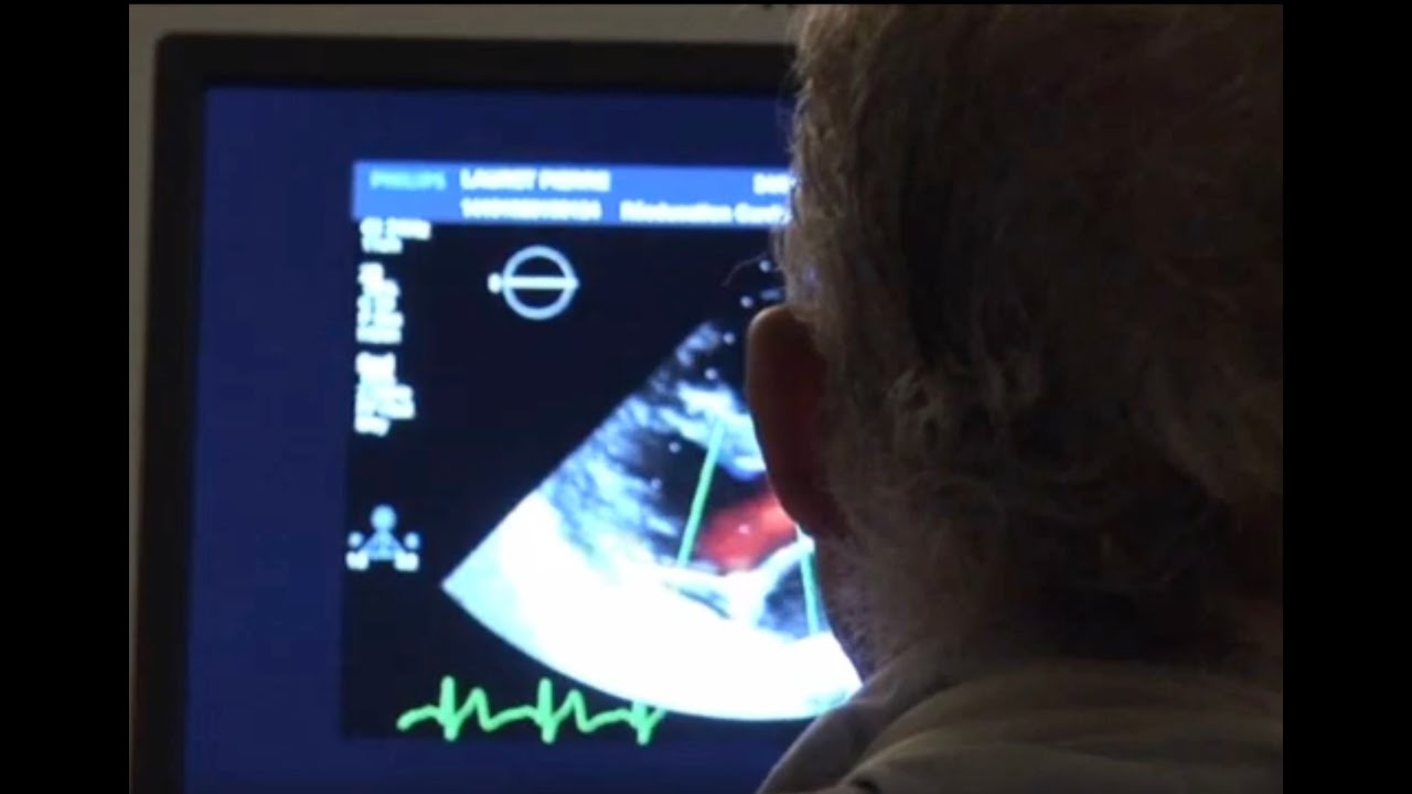 Bilan cardiaque du sportif de haut niveau