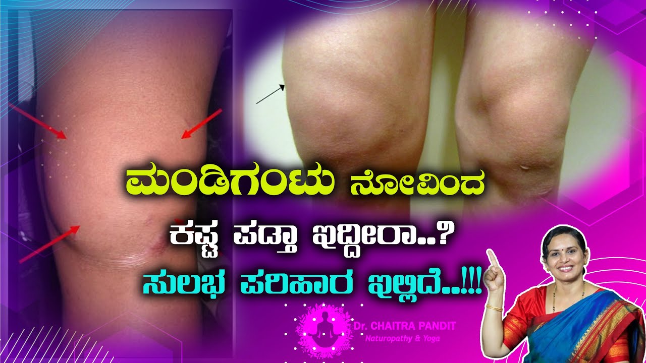 ಮಂಡಿನೋವನ್ನು ತಡೆಗಟ್ಟಲು ಸರಳ ಉಪಾಯ ಇಲ್ಲಿದೆ |  HOW TO PREVENT KNEE JOINT PAIN