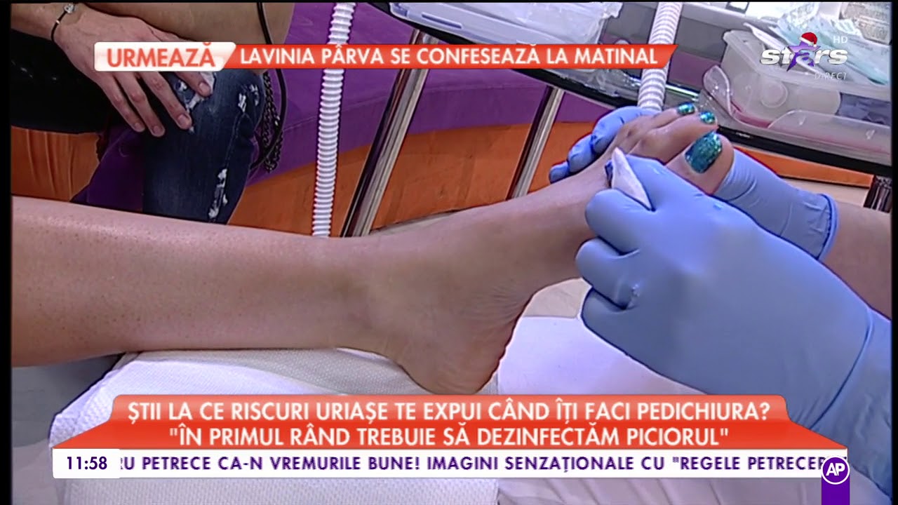 Știi la ce riscuri uriașe te expui când îți faci pedichiura?
