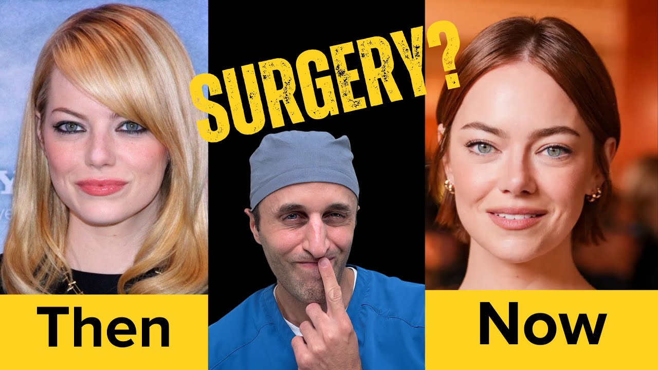 Did Emma Stone Get PLASTIC SURGERY? A Surgeon's Honest Opinion