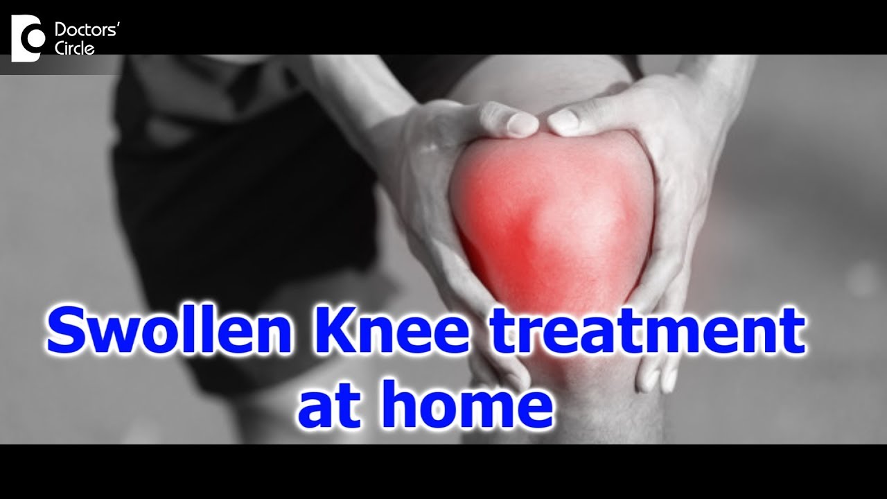 Knee pain and swelling | How to care for a Swollen Knee? - Dr. Mohan M R | Doctors' Circle