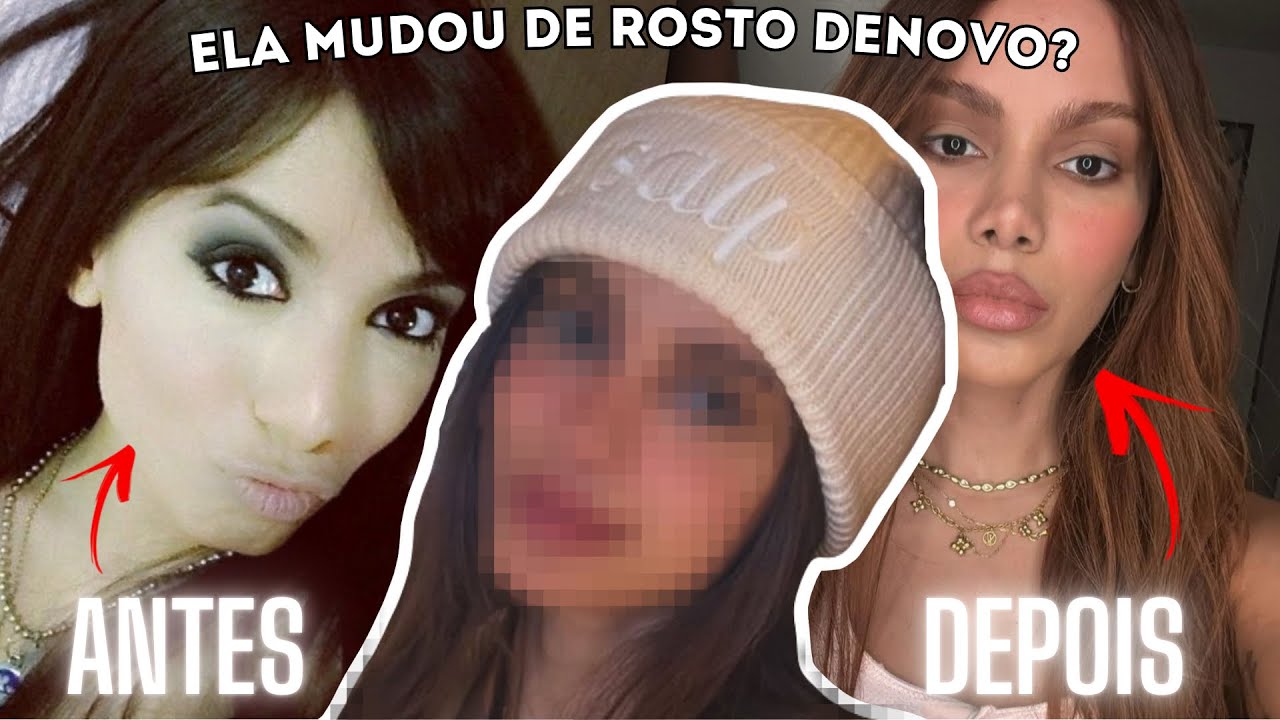 ANTES E DEPOIS: TIER LIST DA CHOCANTE TRANSFORMAÇÃO DO ROSTO DA ANITTA