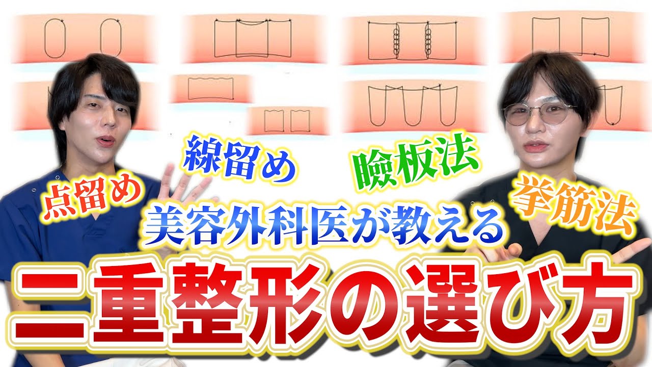 【完全版】これを見れば二重埋没の全てがわかります。埋没前にゼッタイに見て！