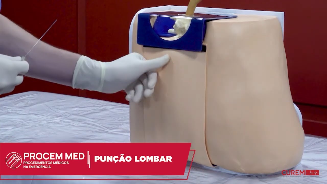 PUN&Ccedil;&Atilde;O LOMBAR - Como realizar?