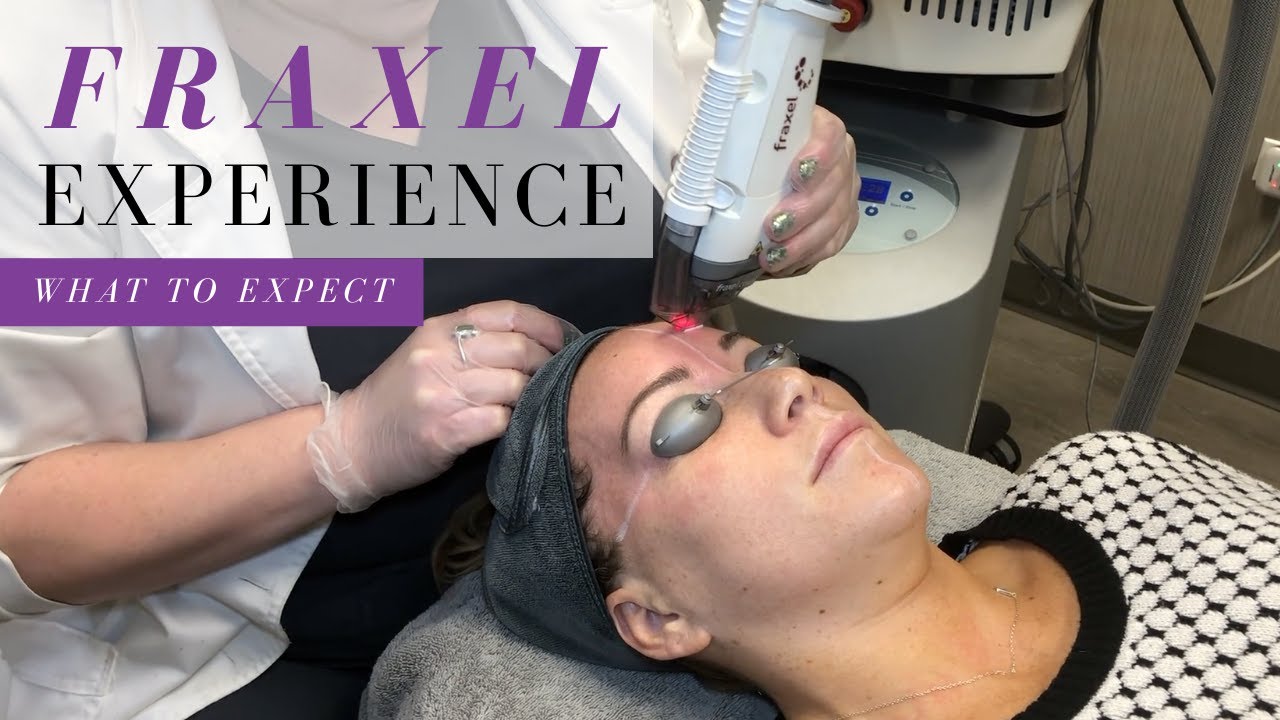 What's It Like to Get Fraxel? Laser Skin Resurfacing Experience