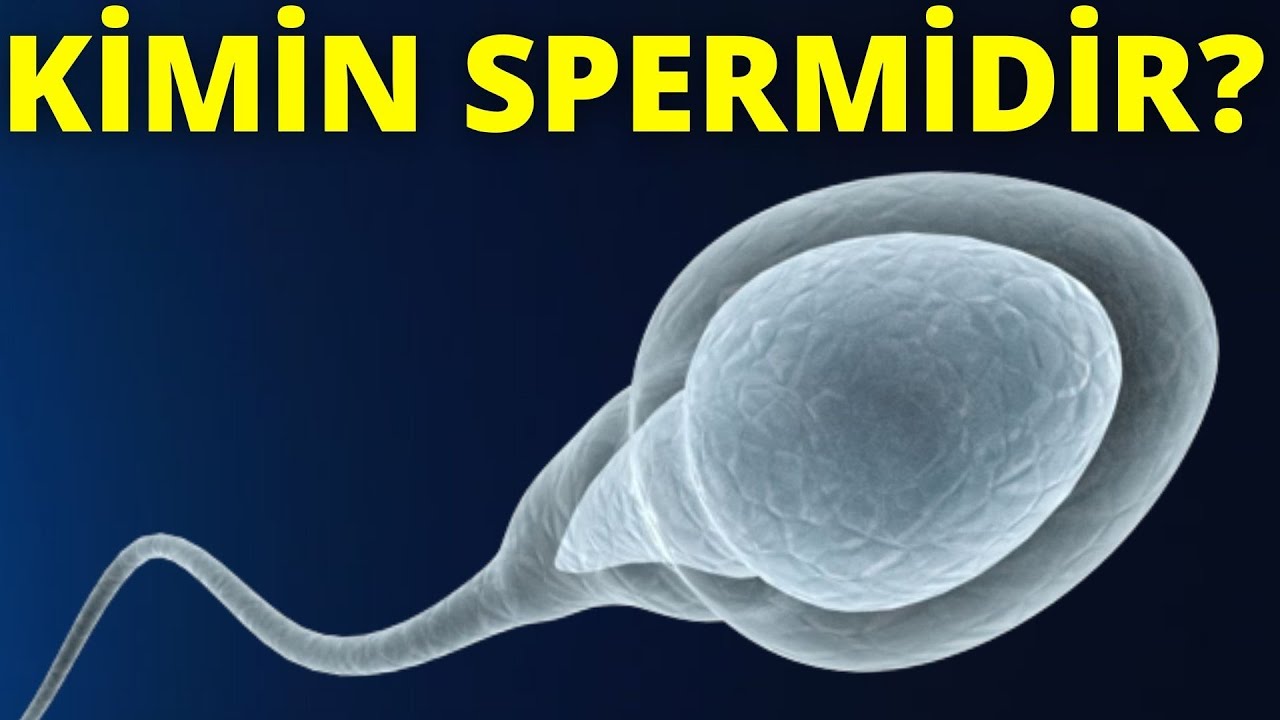 S&uuml;ni Mayalanma Zamanı İstifadə Olunan Sperma Kimindir?